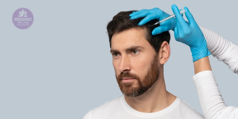 PRP for Hair